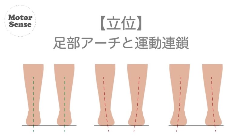 【立位】足部アーチと運動連鎖　整体／リハビリ【十勝帯広】