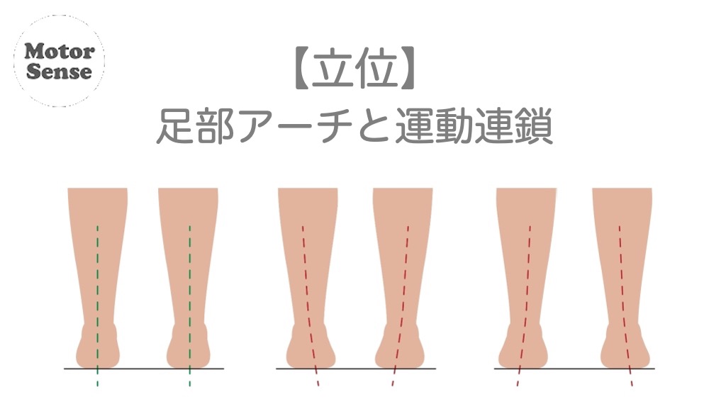 【立位】足部アーチと運動連鎖　整体／リハビリ【十勝帯広】